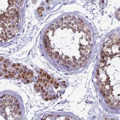 Immunohistochemistry: MFSD12 Antibody [NBP2-47376]