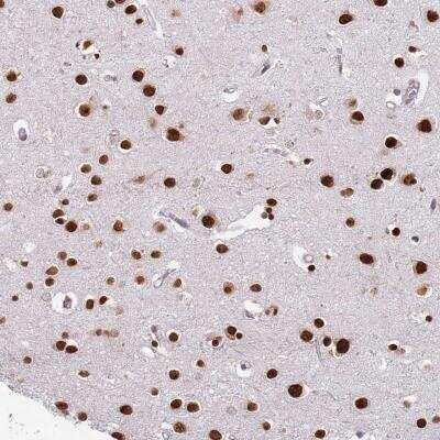 Immunohistochemistry-Paraffin: MFSD12 Antibody [NBP2-48783]