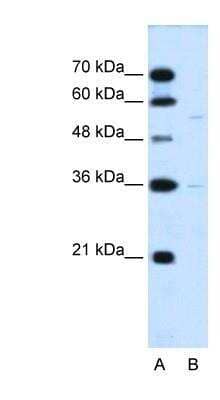 Western Blot: MFSD12 Antibody [NBP1-91591]