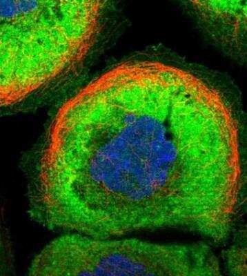 Immunocytochemistry/ Immunofluorescence: MFSD2 Antibody [NBP1-92112]