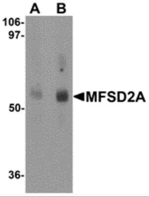 Western Blot: MFSD2 AntibodyBSA Free [NBP2-81929]