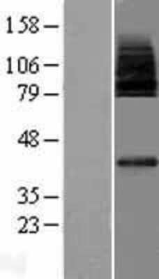 Western Blot: MFSD2 Overexpression Lysate [NBP2-05945]