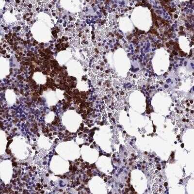 Immunohistochemistry-Paraffin: MFSD2B Antibody [NBP2-14536]