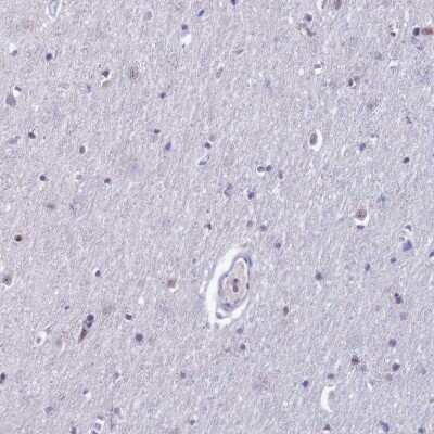 Immunohistochemistry-Paraffin: MFSD2B Antibody [NBP2-14536]