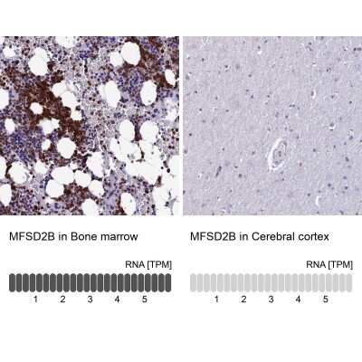 Immunohistochemistry-Paraffin: MFSD2B Antibody [NBP2-14536]