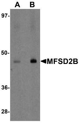 Western Blot: MFSD2B AntibodyBSA Free [NBP2-81737]