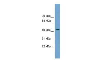 Western Blot: MFSD3 Antibody [NBP2-83199]