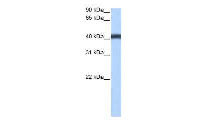 Western Blot: MFSD3 Antibody [NBP2-83200]