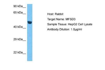 Western Blot: MFSD3 Antibody [NBP2-83201]