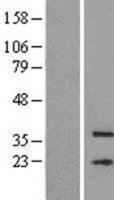 Western Blot: MFSD3 Overexpression Lysate [NBL1-13046]