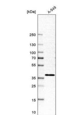 Western Blot: MFSD5 Antibody [NBP1-81224]