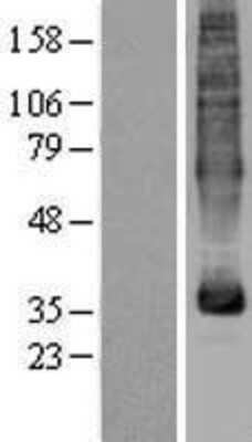 Western Blot: MFSD5 Overexpression Lysate [NBP2-04405]