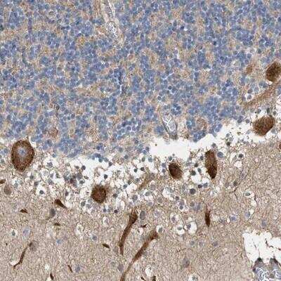 Immunohistochemistry-Paraffin: MFSD6 Antibody [NBP1-82203]