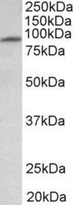 Western Blot: MFSD6 Antibody [NBP2-12935]