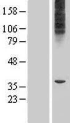 Western Blot: MFSD6L Overexpression Lysate [NBP2-05327]