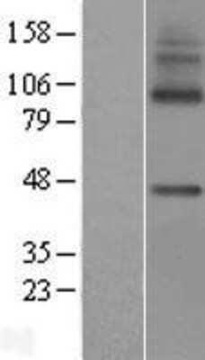 Western Blot: MFSD7 Overexpression Lysate [NBP2-06061]