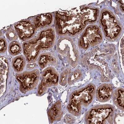 Immunohistochemistry-Paraffin: MFSD8 Antibody [NBP1-92114]