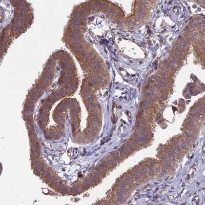 Immunohistochemistry-Paraffin: MFSD8 Antibody [NBP1-92114]