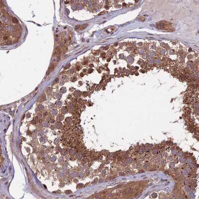 Immunohistochemistry-Paraffin: MFSD8 Antibody [NBP1-92114]