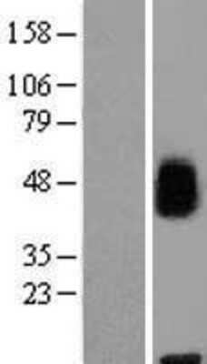 Western Blot: MFSD8 Overexpression Lysate [NBL1-13050]