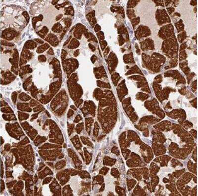 Immunohistochemistry: MFSD9 Antibody [NBP2-30440]