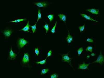 Immunocytochemistry/ Immunofluorescence: MGA Antibody [NBP2-98097]