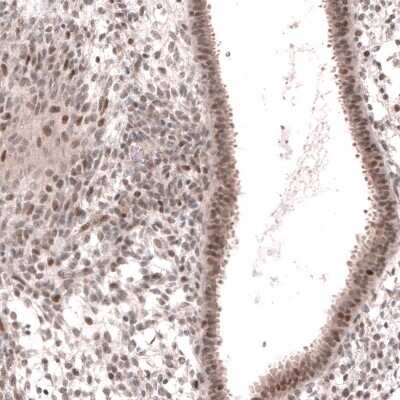 Immunohistochemistry-Paraffin: MGA Antibody [NBP1-94031]