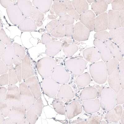 Immunohistochemistry-Paraffin: MGA Antibody [NBP1-94031]