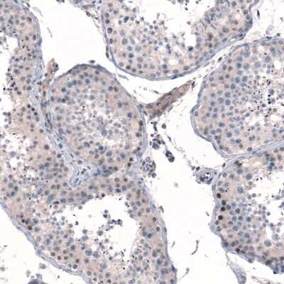 Immunohistochemistry-Paraffin: MGA Antibody [NBP1-94031]