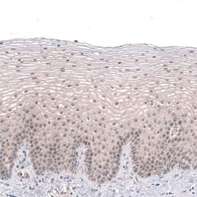 Immunohistochemistry-Paraffin: MGA Antibody [NBP1-94031]