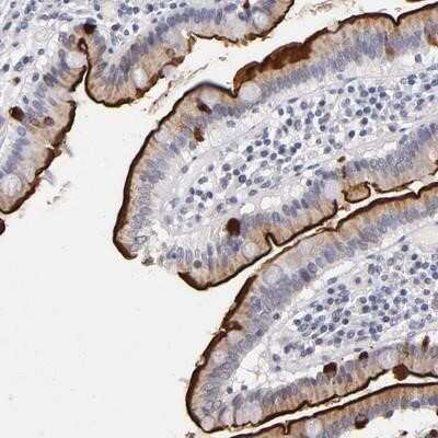 Immunohistochemistry: MGAM Antibody [NBP1-87674]