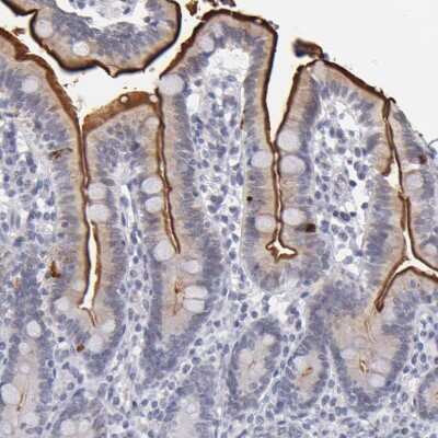 Immunohistochemistry-Paraffin: MGAM Antibody [NBP1-87674]