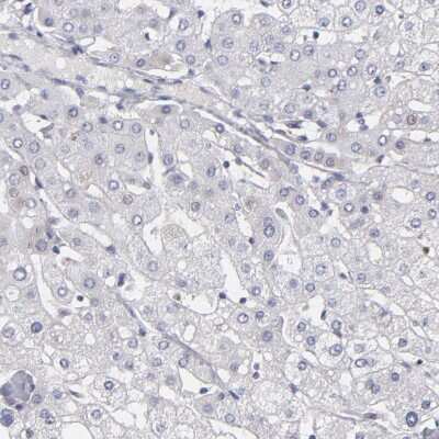 Immunohistochemistry-Paraffin: MGAM Antibody [NBP1-87674]