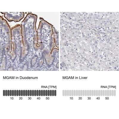 Immunohistochemistry-Paraffin: MGAM Antibody [NBP1-87674]