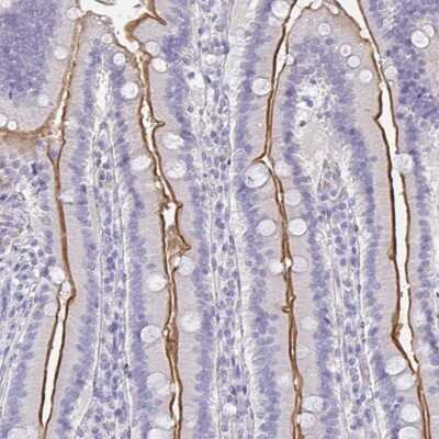 Immunohistochemistry-Paraffin: MGAM2 Antibody [NBP2-47375]