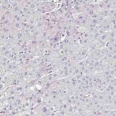 Immunohistochemistry-Paraffin: MGAM2 Antibody [NBP2-47375]