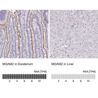 Immunohistochemistry-Paraffin: MGAM2 Antibody [NBP2-47375]