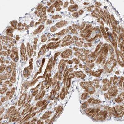 Immunohistochemistry-Paraffin: MGAT1 Antibody [NBP1-81827]