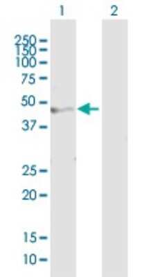 Western Blot: MGAT1 Antibody [H00004245-B01P]