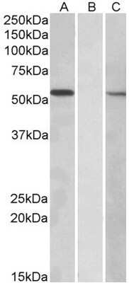 Western Blot: MGAT1 Antibody [NBP1-52077]