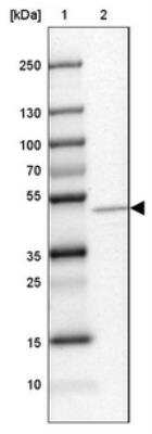 Western Blot: MGAT1 Antibody [NBP1-81827]