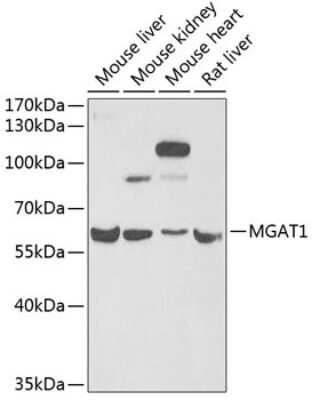 Western Blot: MGAT1 AntibodyBSA Free [NBP3-04742]