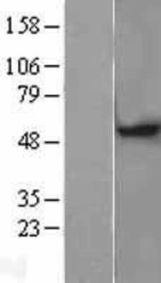 Western Blot: MGAT1 Overexpression Lysate [NBL1-13052]