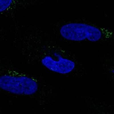 Immunocytochemistry/ Immunofluorescence: MGAT2 Antibody [NBP2-58625]