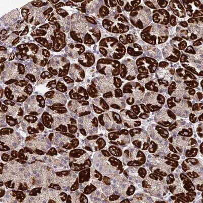 Immunohistochemistry-Paraffin: MGAT2 Antibody [NBP2-14235]