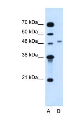 Western Blot: MGAT2 Antibody [NBP1-69335]