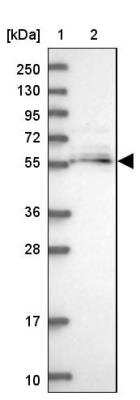 Western Blot: MGAT2 Antibody [NBP2-14235]