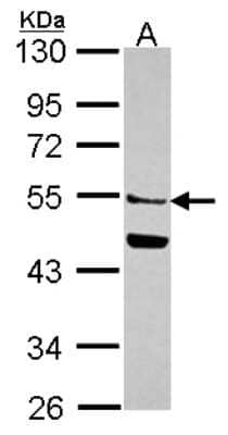 Western Blot: MGAT2 Antibody [NBP2-17284]