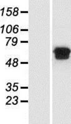 Western Blot: MGAT2 Overexpression Lysate [NBP2-08117]