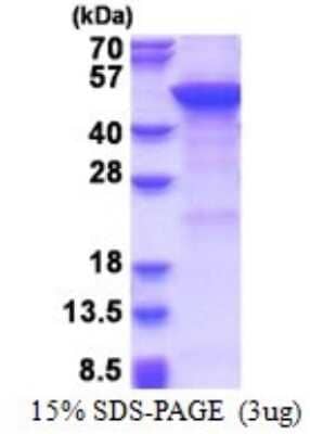 SDS-PAGE: Recombinant Human MGAT2 His Protein [NBP2-51627]